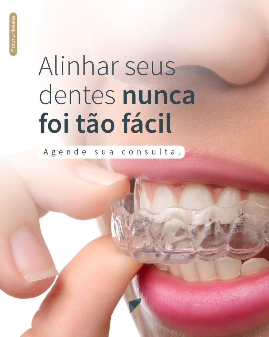 Alinhadores Transparentes
